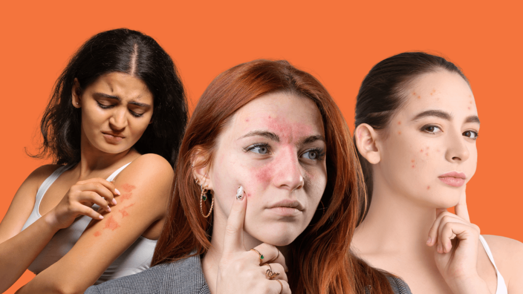 Common skin issues addressed through telehealth dermatology