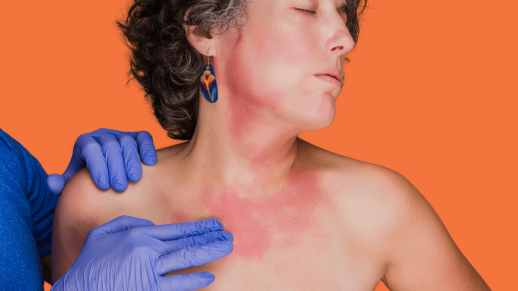 Early diagnosis and treatment: The key to managing skin conditions