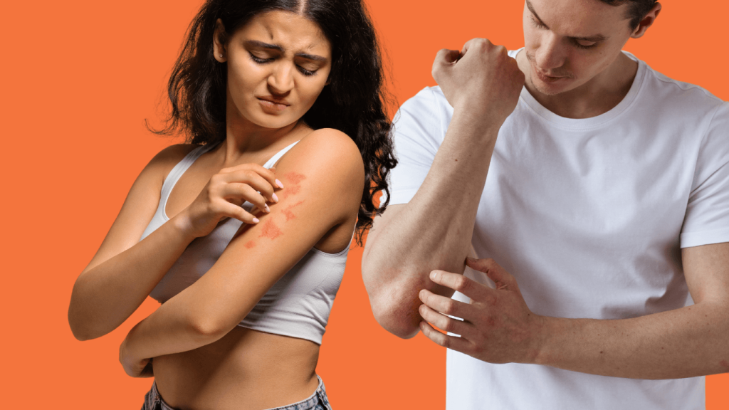 Living with psoriasis: Effective treatment options and lifestyle changes