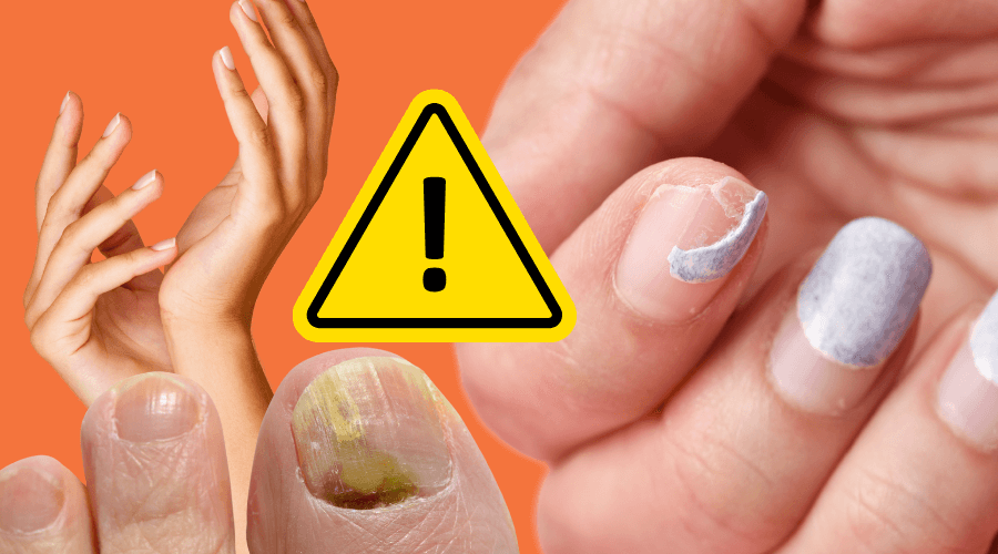 What your nails are telling you about your health: 7 warning signs
