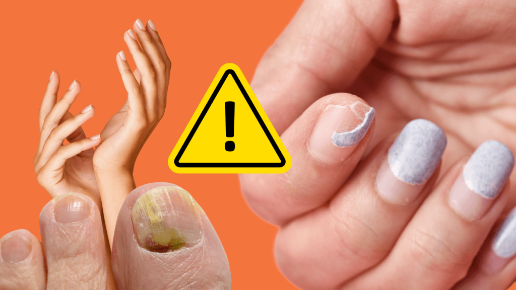 What your nails are telling you about your health: 7 warning signs