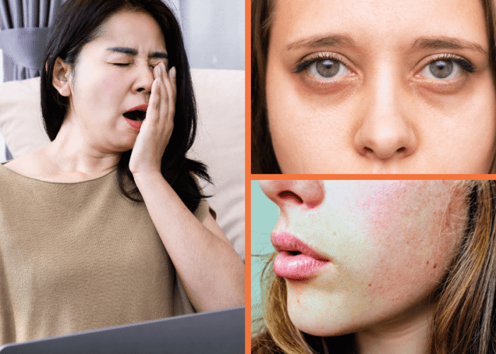 Lack of Sleep Effects on Skin: 7 Ways Poor Rest Ages Your Complexion