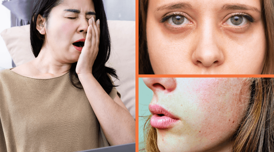 Lack of Sleep Effects on Skin: 7 Ways Poor Rest Ages Your Complexion