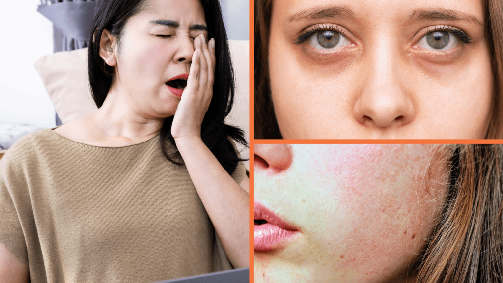 Lack of Sleep Effects on Skin: 7 Ways Poor Rest Ages Your Complexion