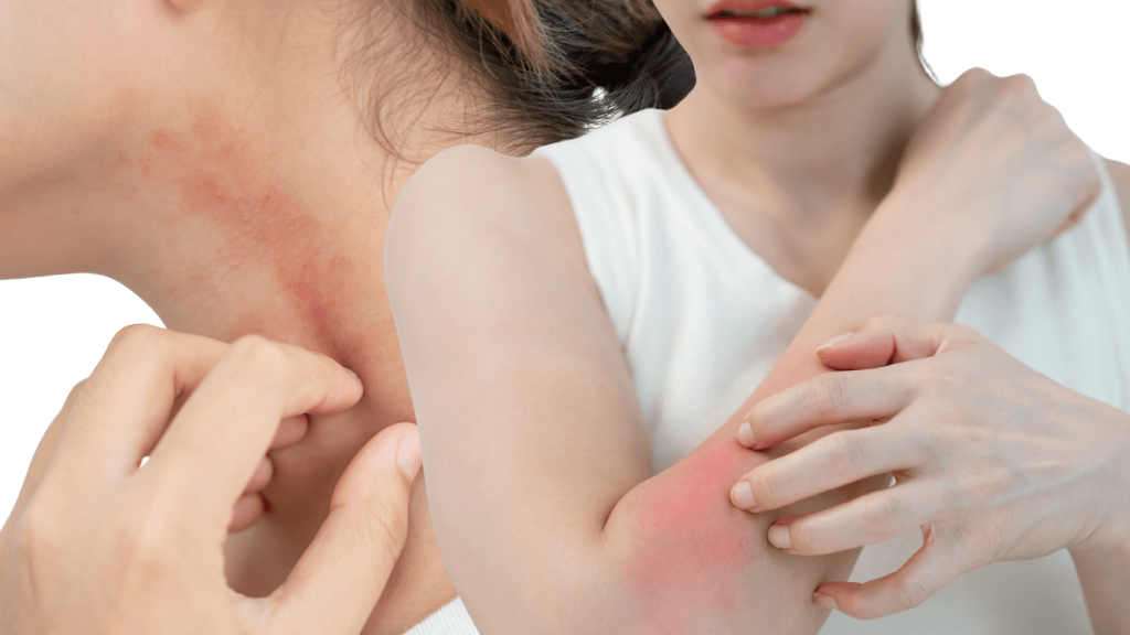 Itchy Skin? Consult a Dermatologist Online for a Clinical Assessment